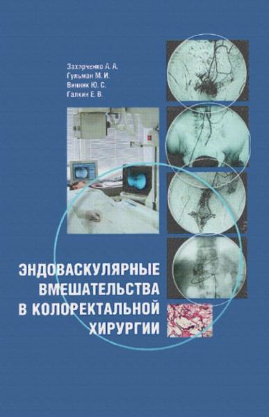 А.А. Захарченко. Эндоваскулярные вмешательства в колоректальной хирургии