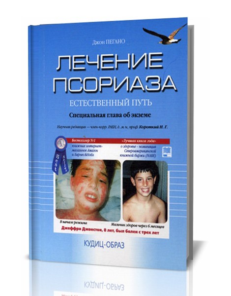 Дж. Пегано. Лечение псориаза: естественный путь